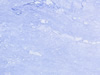 Textures 28