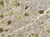 Textures 104