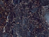 marble 96