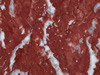 marble 105