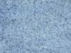 marble 112