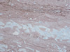 marble 131