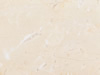 Textures 157
